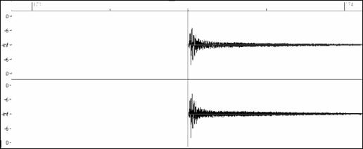 waveform